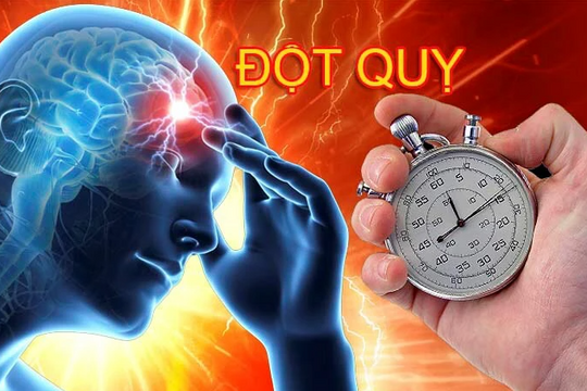 Chỉ cần để ý 7 dấu hiệu này, bạn có thể tránh được cơn đột quỵ nguy hiểm