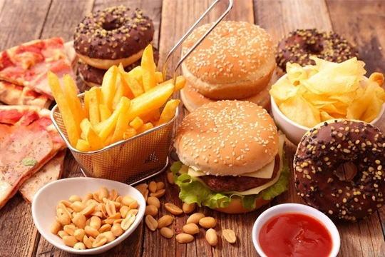 Ba thực phẩm dễ gây xơ vữa động mạch mà nhiều người vẫn dùng mỗi ngày